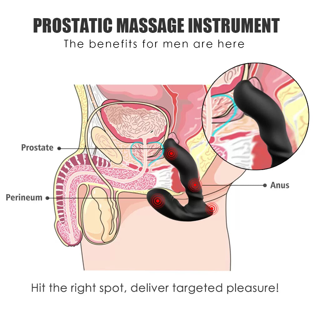 Optimus Rct - Şarjlı Kablosuz Kumandalı Aynı Anda Perine ve Prostat Uyarıcı Güçlü Titreşimli Anal Vibratör